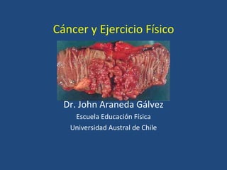 Cáncer y Ejercicio Físico Dr. John Araneda Gálvez Escuela Educación Física Universidad Austral de Chile 