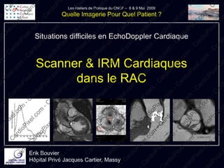 Scanner & IRM Cardiaques
      dans le RAC



                           0,644 cm2
 