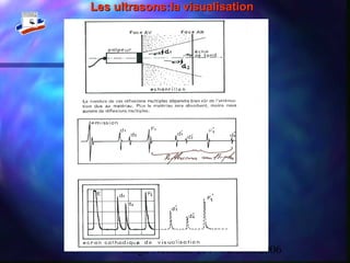 Stage National TIV-Version 200671
Les ultrasons:la visualisationLes ultrasons:la visualisation
 