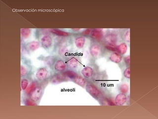 Observación microscópica

 