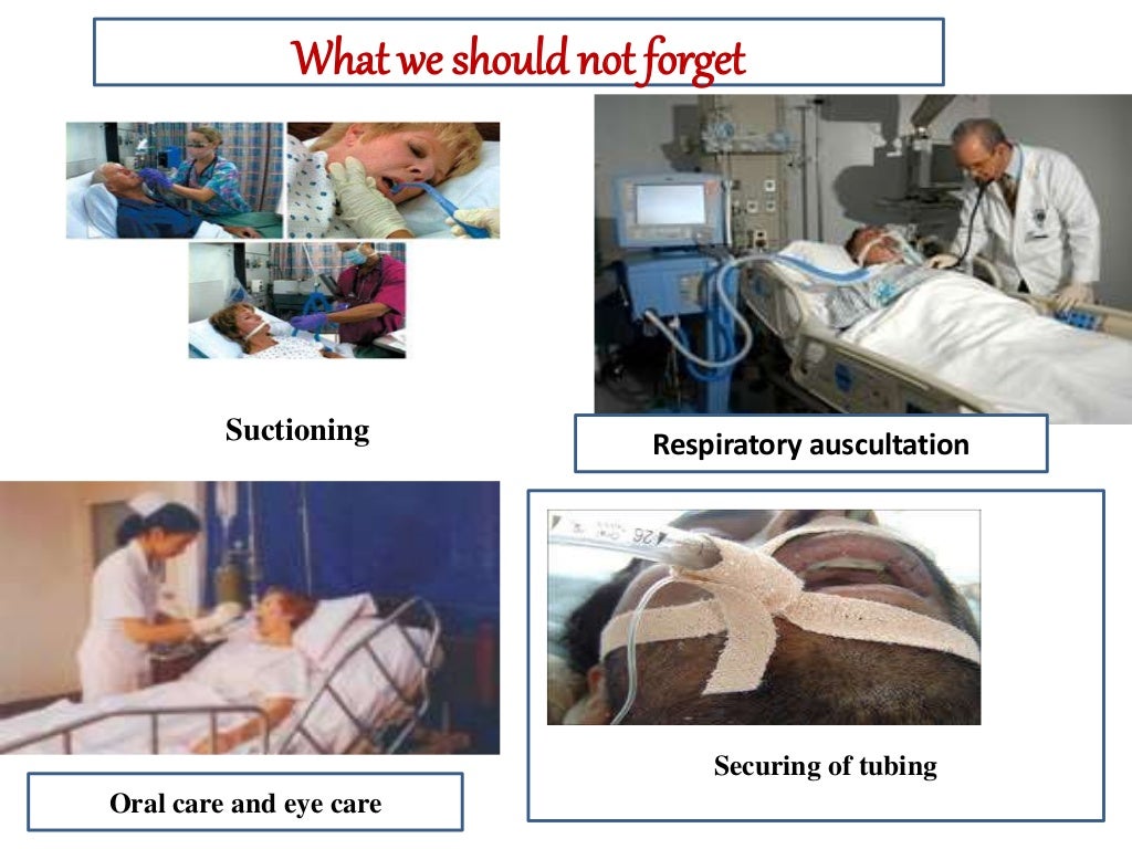 overview of mechanical ventilation and nursing care