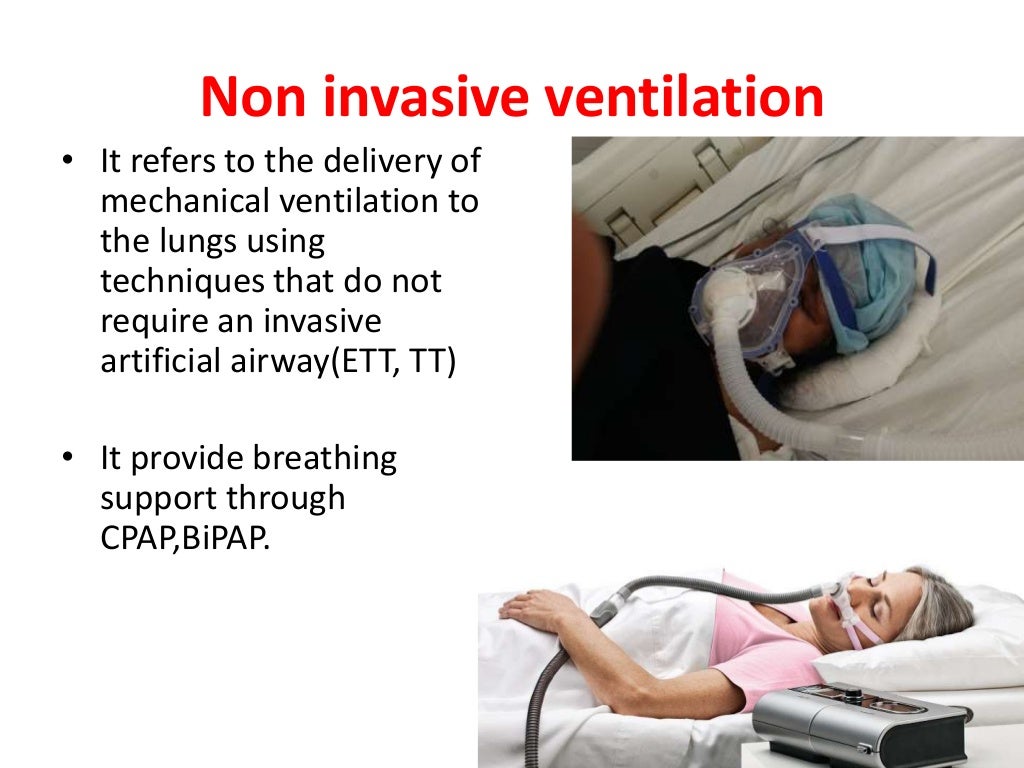 overview of mechanical ventilation and nursing care