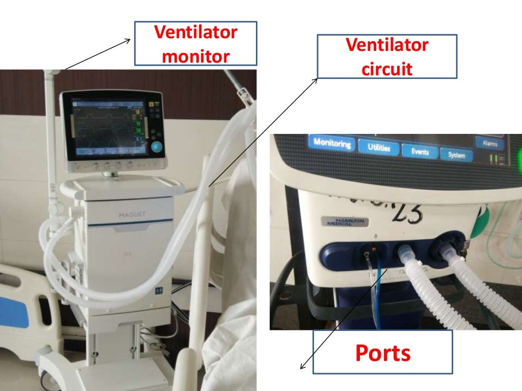 overview of mechanical ventilation and nursing care