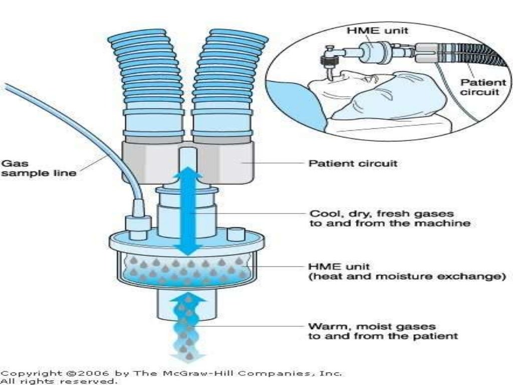 overview of mechanical ventilation and nursing care