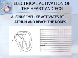 ELECTRICAL ACTIVATION OF THE HEART AND ECG A. SINUS IMPULSE ACTIVATES RT ATRIUM AND REACH THE NODES 