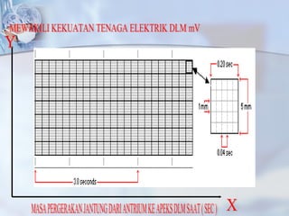 Y X MASA PERGERAKAN JANTUNG DARI ANTRIUM KE APEKS DLM SAAT ( SEC ) MEWAKILI KEKUATAN TENAGA ELEKTRIK DLM mV 