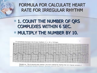 FORMULA FOR CALCULATE HEART RATE FOR IRREGULAR RHYTHM 1. COUNT THE NUMBER OF QRS COMPLEXES WITHIN 6 SEC. MULTIPLY THE NUMBER BY 10. 
