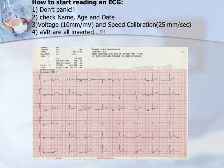 BASIC ECG