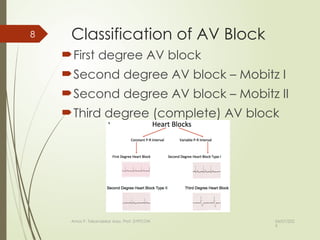Comprehensive Guide to Heart Block and Pacemaker Monitoring for Nursing ...