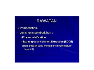 Cne katarak by Sn Syariza