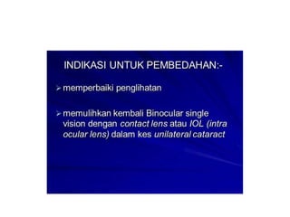 Cne katarak by Sn Syariza