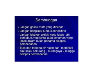 Cne katarak by Sn Syariza