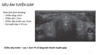 SIÊU ÂM TUYẾN GIÁP
17
Hình ảnh bình thường:
- Chiều rộng <2cm
- Chiều dài < 5cm
- Chiều dày trước sau <2cm
- Eo tuyến dày < 0.5 cm
Chiều dày trước – sau > 2cm  có tăng kích thước tuyến giáp
 
