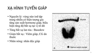 XẠ HÌNH TUYẾN GIÁP
• Nguyên lý: vùng nào iod tập
trung nhiều có hiện tượng gia
tăng sản xuất hormone giáp, biểu
hiện tăng độ bắt xạ tại vị trí đó
• Tăng bắt xạ lan tỏa : Basedow
• Giảm bắt xạ : Viêm giáp, CG do
thuốc
• Nhân nóng: nhân độc giáp
23
 