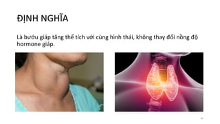 ĐỊNH NGHĨA
Là bướu giáp tăng thể tích với cùng hình thái, không thay đổi nồng độ
hormone giáp.
30
 
