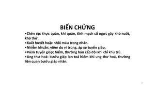 37
BIẾN CHỨNG
•Chèn ép: thực quản, khí quản, tĩnh mạch cổ ngực gây khó nuốt,
khó thở.
•Xuất huyết hoặc nhồi máu trong nhân.
•Nhiễm khuẩn: viêm do vi trùng, áp xe tuyến giáp.
•Viêm tuyến giáp: hiếm, thường bán cấp đôi khi chỉ khu trú.
•Ung thư hoá: bướu giáp lan toả hiếm khi ung thư hoá, thường
liên quan bướu giáp nhân.
 