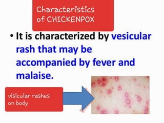Chickenpox | PPTX
