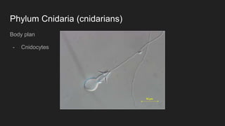 Phylum Cnidaria (cnidarians)
Body plan
- Cnidocytes
 