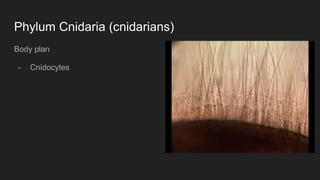 Phylum Cnidaria (cnidarians)
Body plan
- Cnidocytes
 