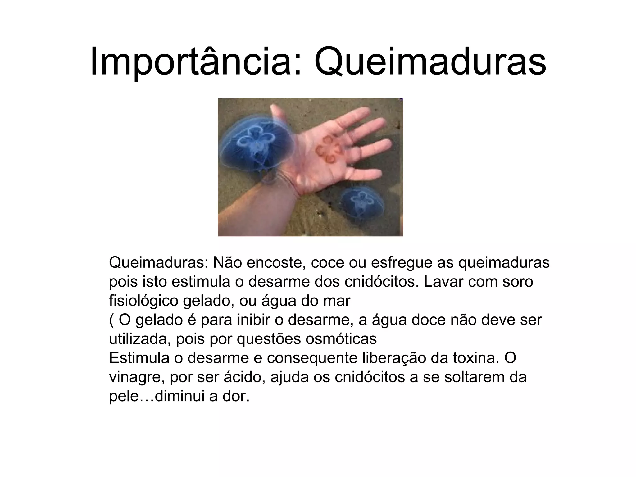 Importância: Queimaduras



 Queimaduras: Não encoste, coce ou esfregue as queimaduras
 pois isto estimula o desarme dos cnidócitos. Lavar com soro
 fisiológico gelado, ou água do mar
 ( O gelado é para inibir o desarme, a água doce não deve ser
 utilizada, pois por questões osmóticas
 Estimula o desarme e consequente liberação da toxina. O
 vinagre, por ser ácido, ajuda os cnidócitos a se soltarem da
 pele…diminui a dor.
 