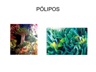 PÓLIPOS
 