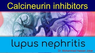 lupus nephritis
Calcineurin inhibitors
Dr. Mohammad Hassan Jokar
 