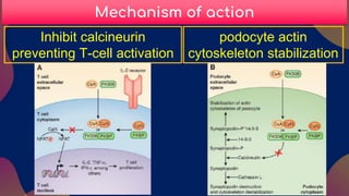 Calcineurin inhibitors in lupus nephritis. | PDF