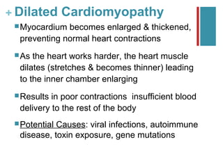 + Dilated Cardiomyopathy
  Myocardium becomes enlarged & thickened,
  preventing normal heart contractions
  As the heart works harder, the heart muscle
  dilates (stretches & becomes thinner) leading
  to the inner chamber enlarging
  Results in poor contractions insufficient blood
  delivery to the rest of the body
  PotentialCauses: viral infections, autoimmune
  disease, toxin exposure, gene mutations
 