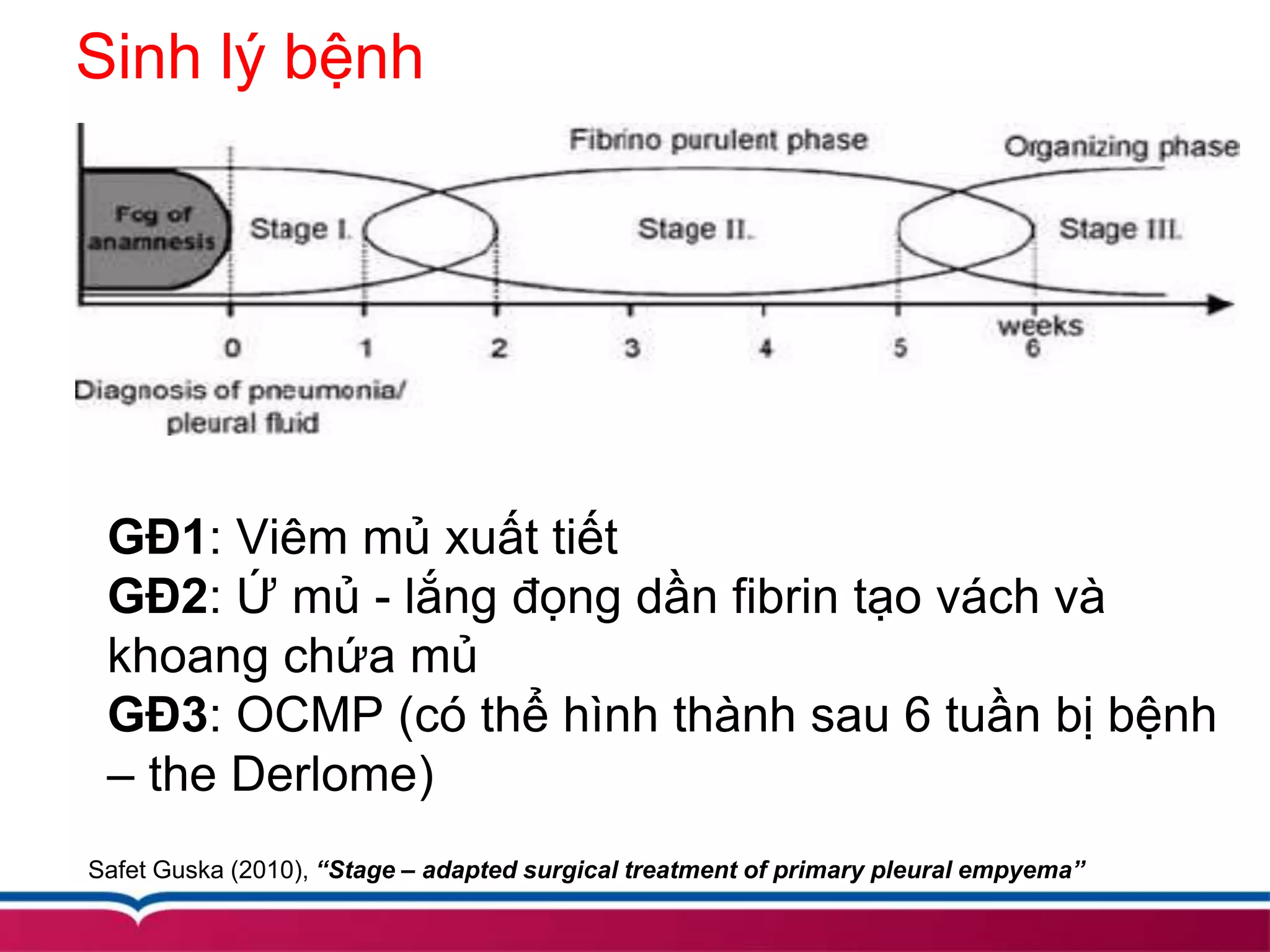 Sinh lý bệnh
GĐ1: Viêm mủ xuất tiết
GĐ2: Ứ mủ - lắng đọng dần fibrin tạo vách và
khoang chứa mủ
GĐ3: OCMP (có thể hình thành sau 6 tuần bị bệnh
– the Derlome)
Safet Guska (2010), “Stage – adapted surgical treatment of primary pleural empyema”
 