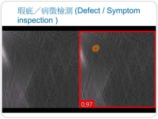 瑕疵／病徵檢測 (Defect / Symptom
inspection )
 