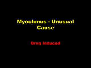 Myoclonus - Unusual
Cause
Drug Induced

 
