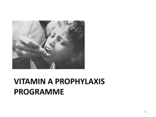 VITAMIN A PROPHYLAXIS
PROGRAMME
12
 