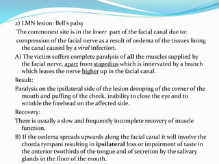 2) LMN lesion: Bell’s palsy
The commonest site is in the lower part of the facial canal due to:
compression of the facial nerve as a result of oedema of the tissues lining
the canal caused by a viral infection.
A) The victim suffers complete paralysis of all the muscles supplied by
the facial nerve, apart from stapedius which is innervated by a branch
which leaves the nerve higher up in the facial canal.
Result:
Paralysis on the ipsilateral side of the lesion drooping of the corner of the
mouth and puffing of the cheek, inability to close the eye and to
wrinkle the forehead on the affected side.
Recovery:
There is usually a slow and frequently incomplete recovery of muscle
function.
B) If the oedema spreads upwards along the facial canal it will involve the
chorda tympani resulting in ipsilateral loss or impairment of taste in
the anterior twothirds of the tongue and of secretion by the salivary
glands in the floor of the mouth.
 