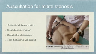 Patient in left lateral position
Breath held in expiration
Using bell of stethoscope
Time the Murmur with carotid
 
