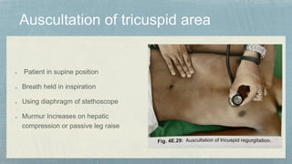 Patient in supine position
Breath held in inspiration
Using diaphragm of stethoscope
Murmur Increases on hepatic
compression or passive leg raise
 
