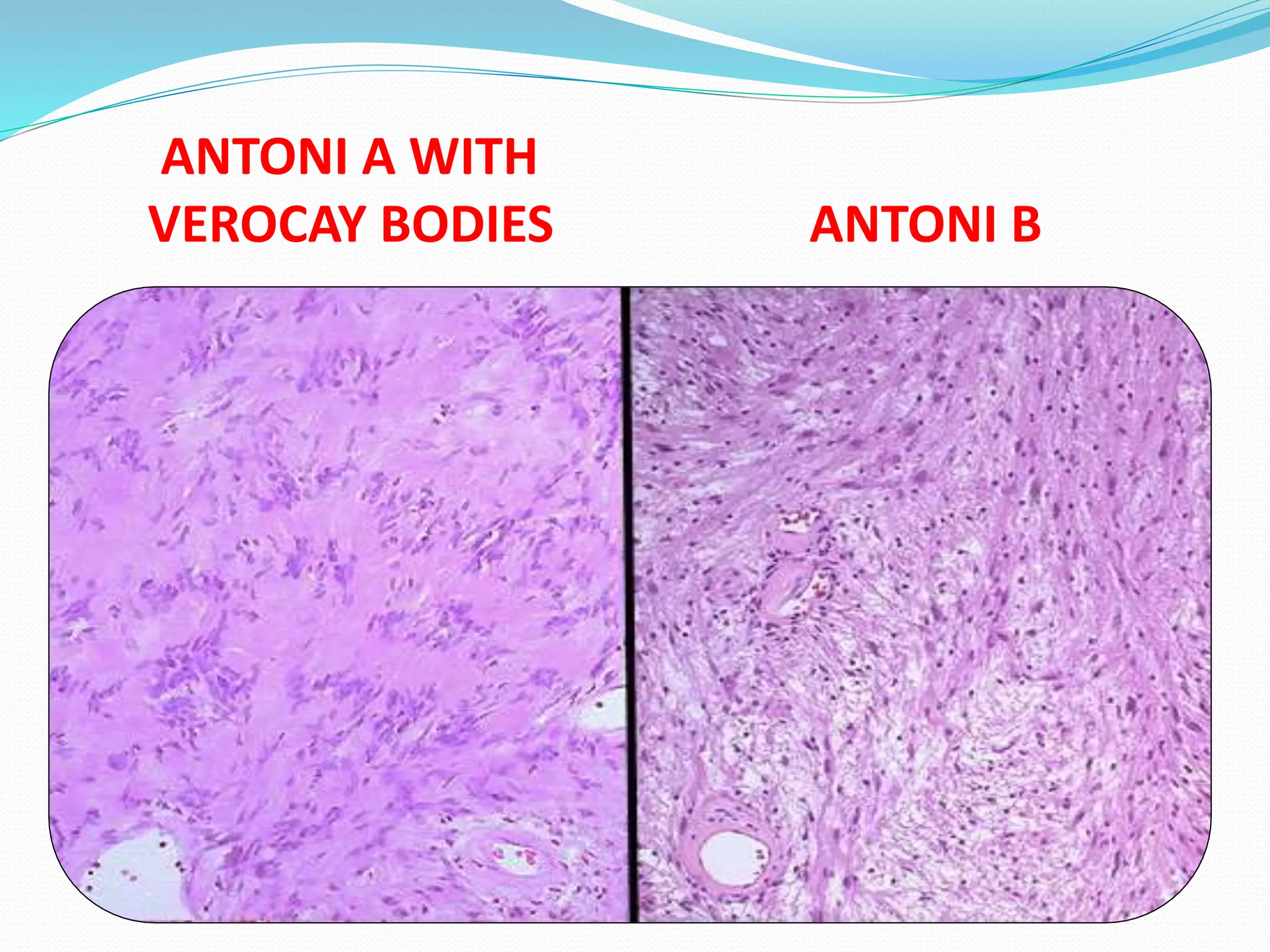 ANTONI A WITH
VEROCAY BODIES ANTONI B
 