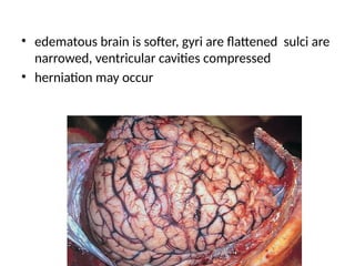centeral nervous system and spinal cordpathology | PPTX