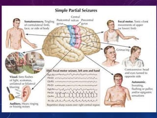 PARTIAL SEIZURES :
 SIMPLE PARTIAL SEIZURES:
• Sudden onset
• Unilateral clonic jerking of a group of muscles or a
limb lasting 30 -90 sec, or localized sensory
distrubances such as pin pricks, visual auditory
hallucinations, etc. depending on the area of the
cortex involved.
• Patient remains conscious and aware of the attack.
 