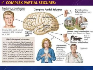  COMPLEX PARTIAL SEIZURES:
• Attacks are bizarre and confused behaviour, dream
like state and purposeless movements, or even
walking unaware, emotional changes lasting 1- 2
mins along with impairment of consciousness.
• Patient cannot recollect the attack.
• An aura often precedes.
• Seizure focus – temporal lobe – Temporal lobe
epilepsy.
 