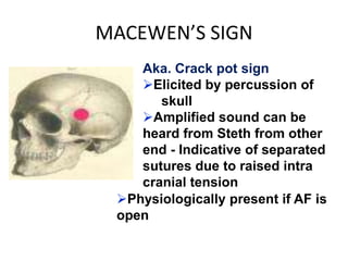 MACEWEN’S SIGN
    Aka. Crack pot sign
    Elicited by percussion of
       skull
    Amplified sound can be
    heard from Steth from other
    end - Indicative of separated
    sutures due to raised intra
    cranial tension
 Physiologically present if AF is
 open
 