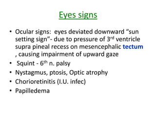 Eyes signs
• Ocular signs: eyes deviated downward “sun
  setting sign”- due to pressure of 3rd ventricle
  supra pineal recess on mesencephalic tectum
  , causing impairment of upward gaze
• Squint - 6th n. palsy
• Nystagmus, ptosis, Optic atrophy
• Chorioretinitis (I.U. infec)
• Papilledema
 