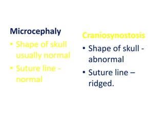 Microcephaly       Craniosynostosis
• Shape of skull   • Shape of skull -
  usually normal     abnormal
• Suture line -    • Suture line –
  normal             ridged.
 