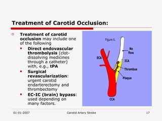 Treatment of Carotid Occlusion: Treatment of carotid occlusion  may include one of the following  Direct endovascular thrombolysis  (clot-dissolving medicines through a catheter) with, e.g.,  tPA   Surgical revascularization : urgent carotid endarterectomy and thrombectomy EC-IC (brain) bypass : used depending on many factors. 