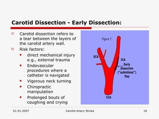 Carotid Dissection - Early Dissection: Carotid dissection refers to a tear between the layers of the carotid artery wall.  Risk factors:  direct mechanical injury e.g., external trauma Endovascular procedures where a catheter is navigated Vigorous neck turning Chiropractic manipulation Prolonged bouts of coughing and crying 