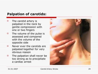 Palpation of carotids: The carotid artery is palpated in the neck by gentle compression with one or two fingers The volume of the pulse is assessed and compared with the volume of the opposite side Never ever the carotids are palpated together for very obvious reason The palpation shall never be too strong as to precipitate a cardiac arrest 