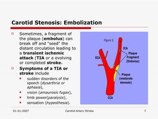 Carotid Stenosis: Embolization Sometimes, a fragment of the plaque ( embolus ) can break off and "seed" the distant circulation leading to a  transient ischemic attack  ( TIA  or a evolving or completed  stroke. Symptoms of a TIA or stroke  include  sudden disorders of the speech ( dysarthria  or  aphasia ),  vision ( amaurosis fugax ),  limb power( paralysis ), sensation ( hypesthesia ). 