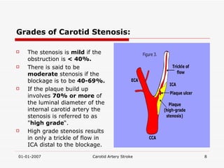 Grades of Carotid Stenosis: The stenosis is  mild  if the obstruction is  < 40%. There is said to be  moderate  stenosis if the blockage is to be  40-69%.   If the plaque build up involves  70% or more  of the luminal diameter of the internal carotid artery the stenosis is referred to as " high grade “. High grade stenosis results in only a trickle of flow in ICA distal to the blockage. 