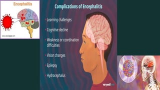 CNS-Infections-and-Diseases (1).pptx brain and spinal cord | PPTX