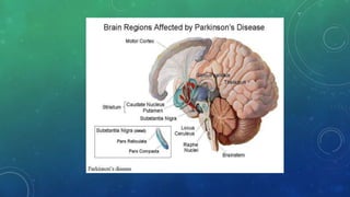 Neurodegenerative | PPT
