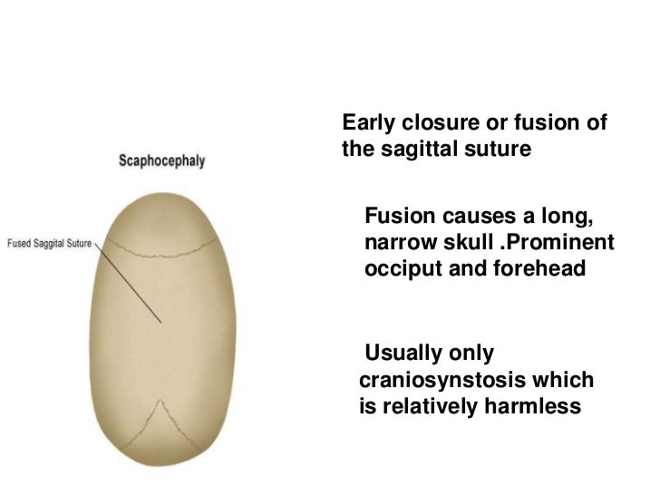Neural tube defects and Craniosynostosis